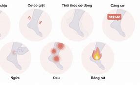 Thuốc Trị Hội Chứng Chân Không Nghỉ